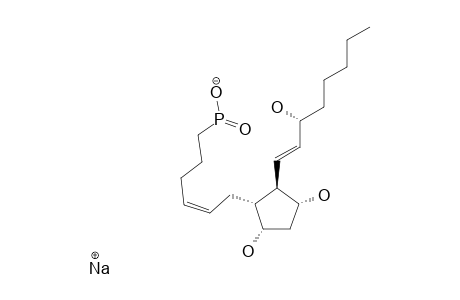 2-DECARBOXY-2-PHOSPHINICO-PROSTAGLANDIN-F(2-ALPHA)-SODIUM-SALT