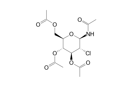 Acetamide, N-(3,4,6-tri-O-acetyl-2-chloro-2-deoxy-.beta.-D-glucopyranosyl)-