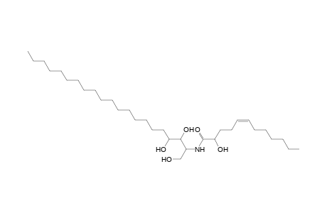 Cer 21:0;3O/12:1;(2OH)