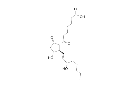 Prost-13-en-1-oic acid, 11,15-dihydroxy-7,9-dioxo-, (11.alpha.,13E,15S)-