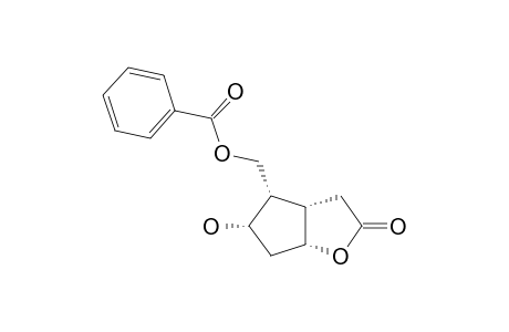 (1R,5S,6R,7S)-6-BENZOYLOXYMETHYL-7-HYDROXY-2-OXABICYCLO-[3.3.0]-OCTAN-3-ONE