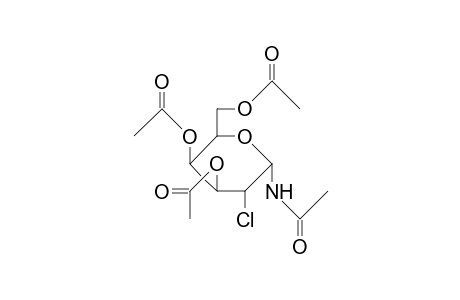 1-N-Acetyl-3,4,6-tri-O-acetyl-2-chloro-2-deoxy-A-D-galactopyranosylamine