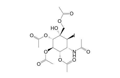 (1S,2R,3S,4S,5S,6R)-6-Acetamido-4-(acetoxymethyl)-4-hydroxy-5-iodocyclohexane-1,2,3-triyl triacetate