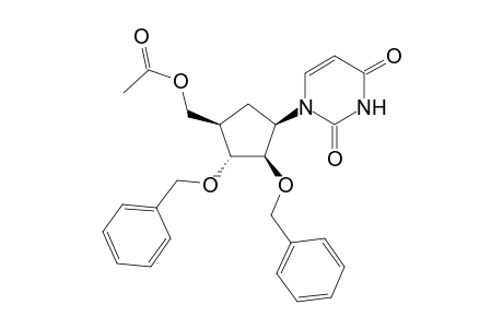 [(1R,2R,3R,4R)-2,3-dibenzyloxy-4-(2,4-dioxopyrimidin-1-yl)cyclopentyl]methyl acetate