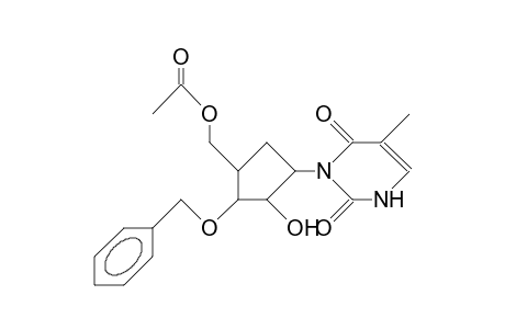1-Thymine 5-O-acetyl-3-O-benzyl-A-D-carbaxyloside