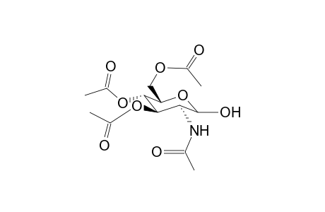 2-Acetylamino-2-deoxy-3,4,6-tri-O-acetyl-d-glucopyranose