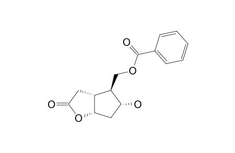 (1R,5S,6S,7S)-6-BENZOYLOXYMETHYL-7-HYDROXY-2-OXABICYCLO-[3.2.0]-OCTAN-3-ONE