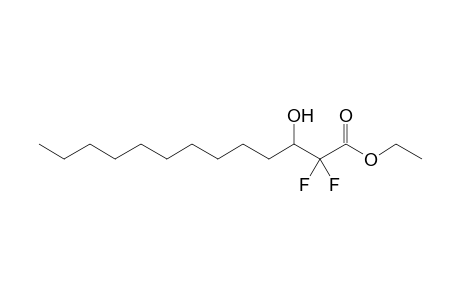 Ethyl 2,2-difluoro-3-hydroxytridecanoate