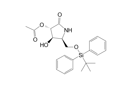(3S,4R,5S)-3-Acetoxy-5-(tert-butyldiphenylsiloxy)methyl-4-hydroxypyrrolidin-2-one