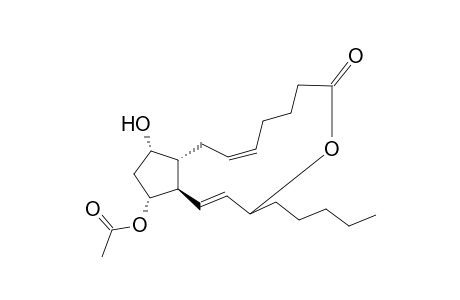 Prostaglandin F(2.alpha.) 1,15-lactone 11-acetate