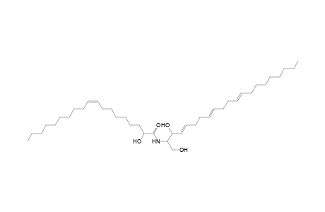 Cer 21:3;2O/19:1;(2OH)