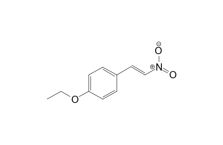 1-Ethoxy-4-[(E)-2-nitroethenyl]benzene