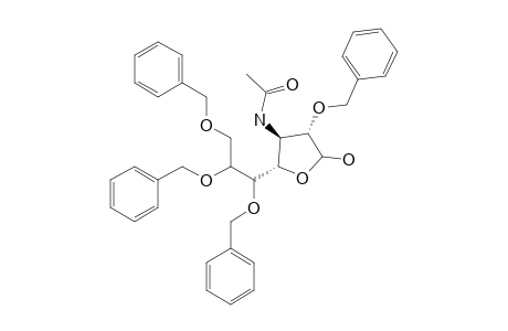 3-ACETAMIDO-2,5,6,7-TETRA-O-BENZYL-3-DEOXY-D-GLYCERO-D-GALACTO-HEPTOFURANOSE,MAJOR-ISOMER;(ALPHA-D)
