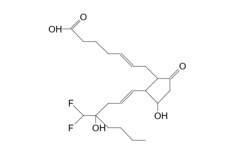 DL-15-Deoxy-16-hydroxy-16-(difluoromethyl)-prostaglandin-E2,epimer-1