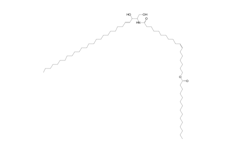 Cer 28:1;2O/18:1;O(FA 15:0)