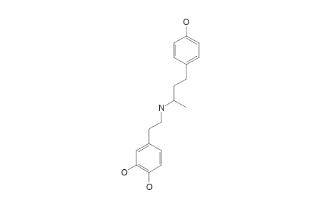 Dobutamine artifact