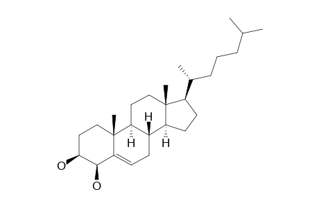 4β-Hydroxycholesterol